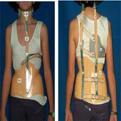 بریس میلواکی