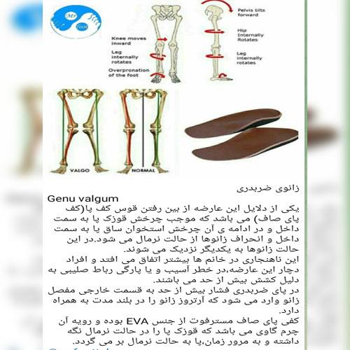 زانوی ضربدری